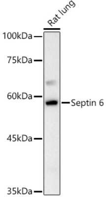 Western Blot: Septin-6 AntibodyBSA Free [NBP3-03686]